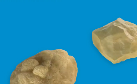 Two kidney stones over a blue background