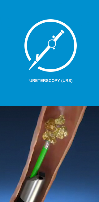 ureterscopy (URS) ureterscopy (URS)