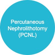 Percutaneous  Nephrolithotomy  (PCNL)
